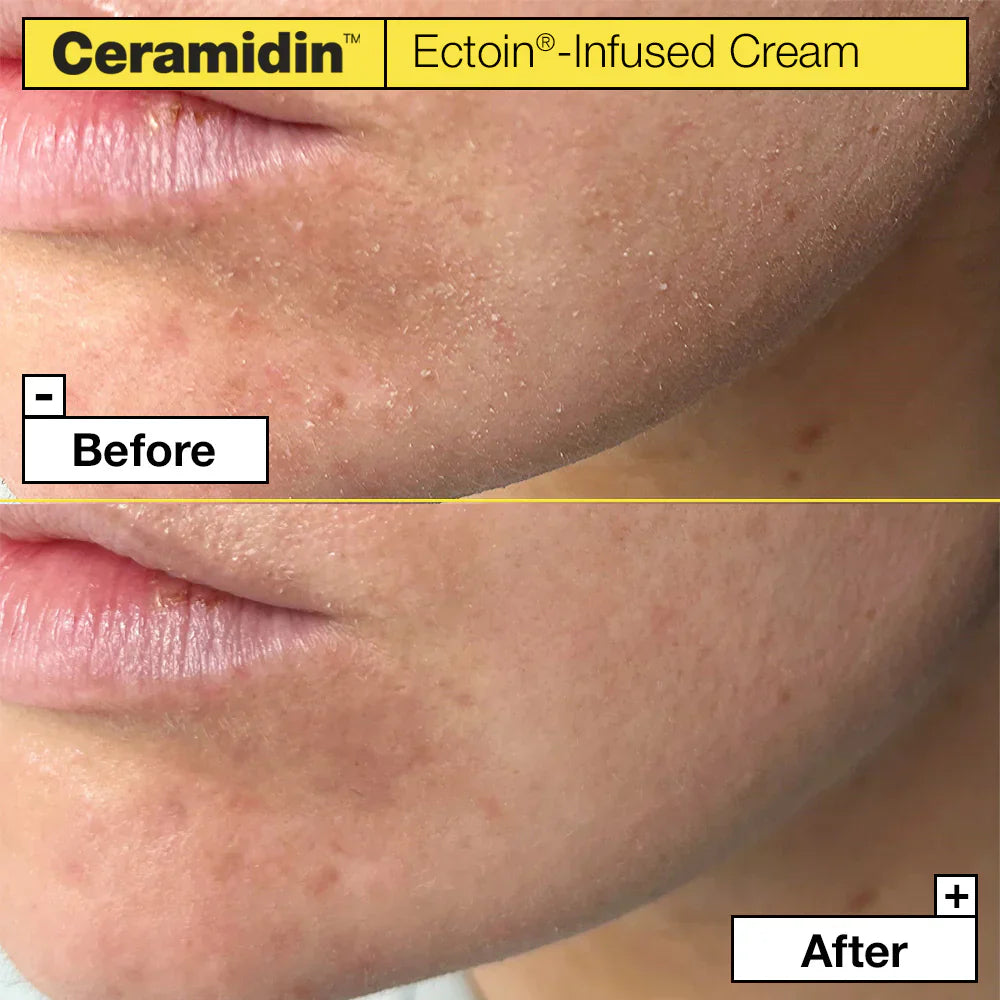 Ceramidin™ Ectoin-Infused Cream